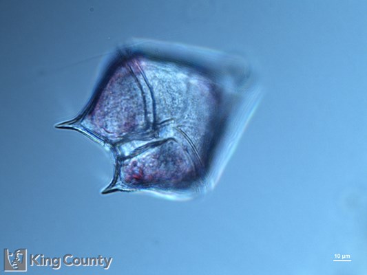 Photo of Protoperidinium conicum/Protoperidinium leonis